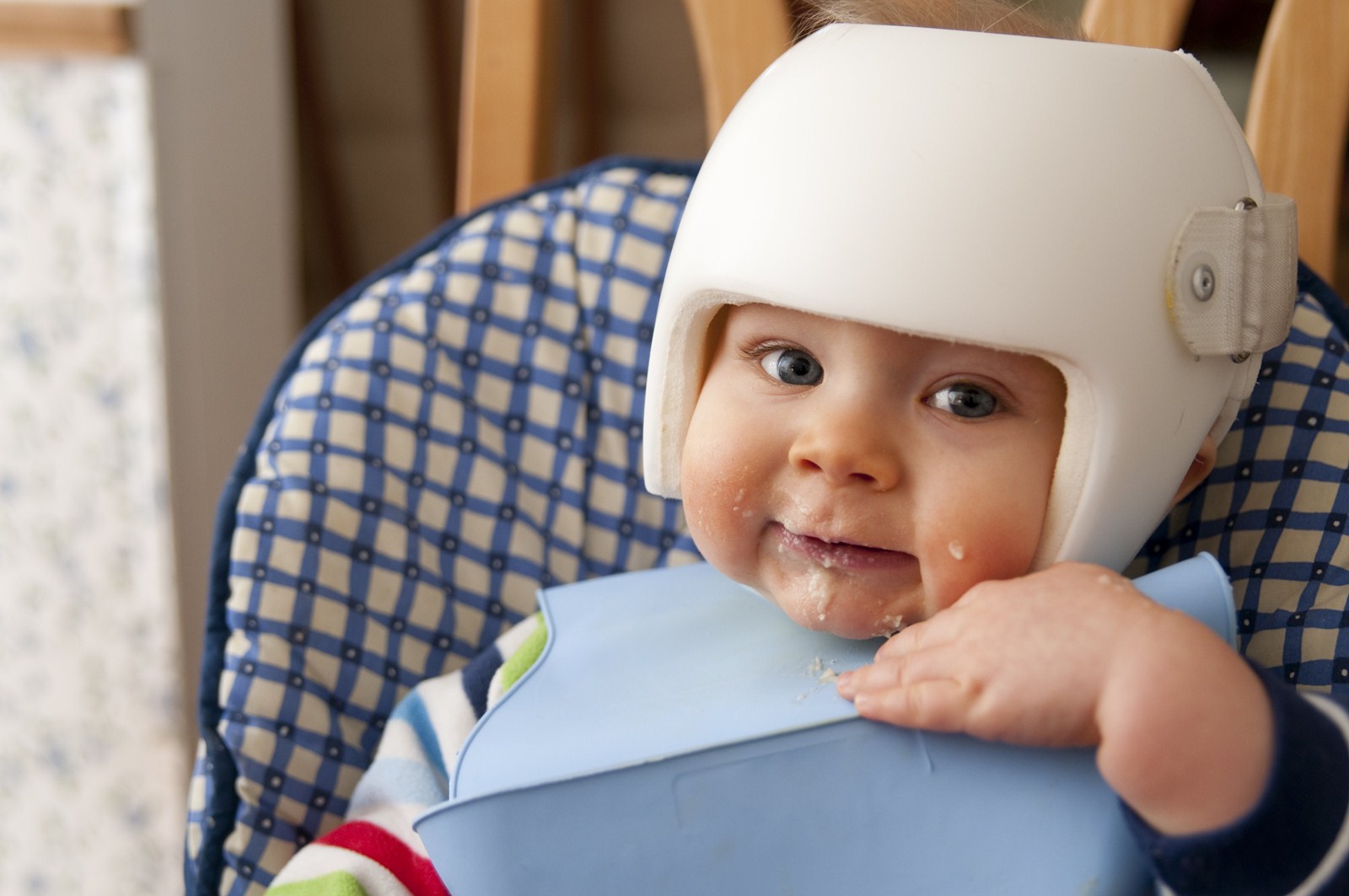 Flat Skull Spot in Most Babies photo pics Flat Skull Spot in Most Babies